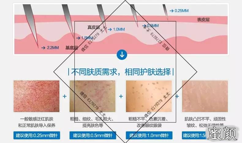 案例图片