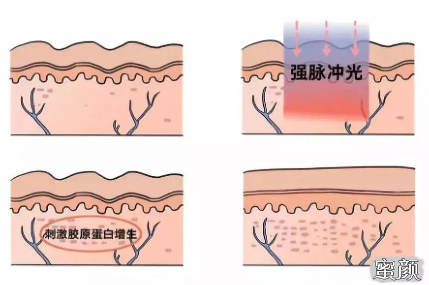 案例图片