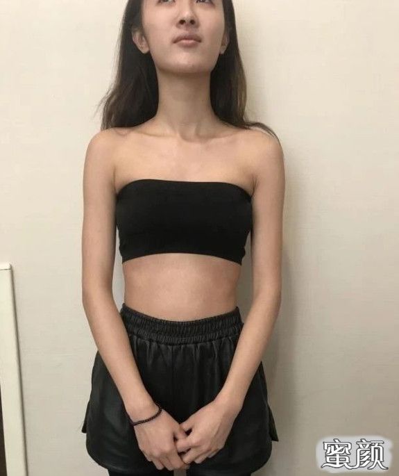 案例图片