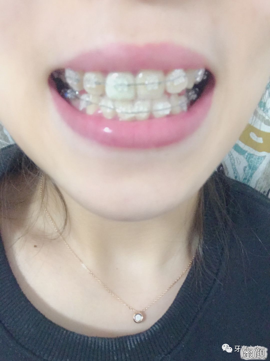 案例图片