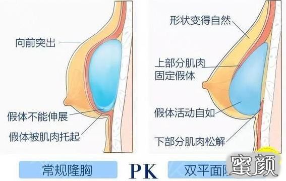 案例图片