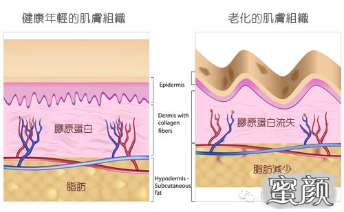 https://img.yiyiaimei.com/mnt/timg/210207/12461C405-2.jpg