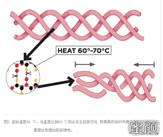 案例图片