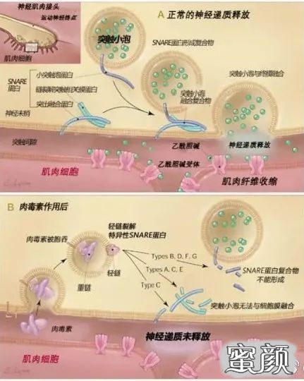 案例图片