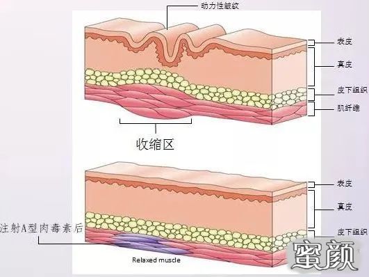 案例图片