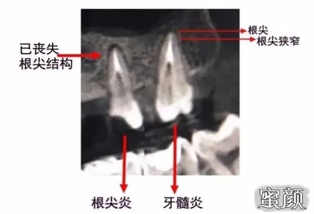 案例图片