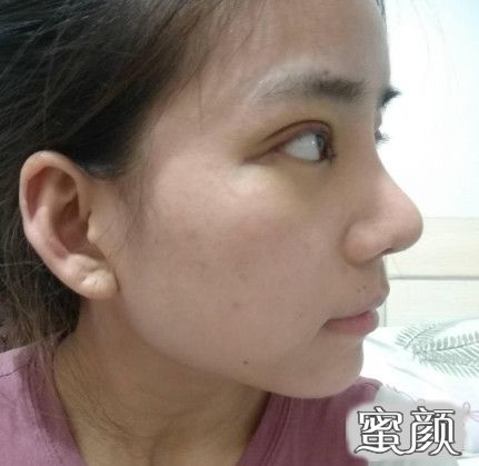 案例图片