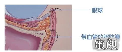 案例图片