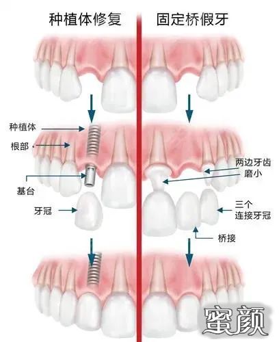 案例图片