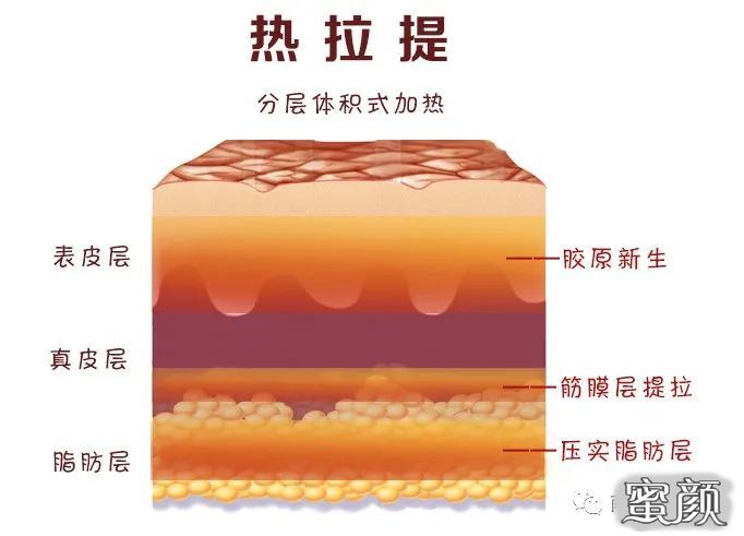 https://img.yiyiaimei.com/mnt/timg/210211/13022a015-8.jpg