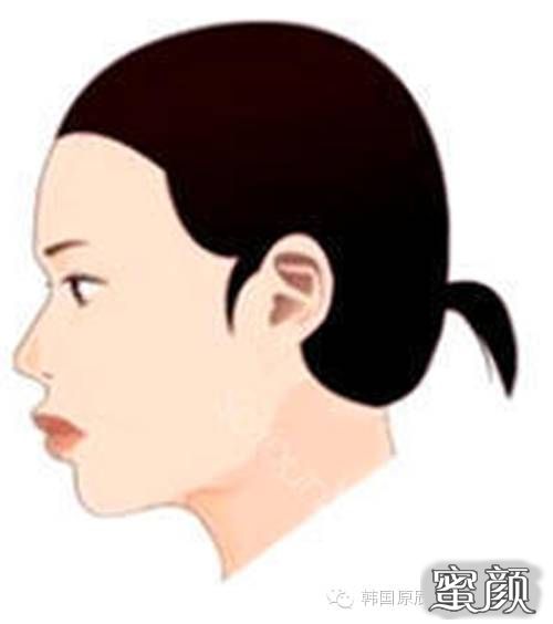 案例图片