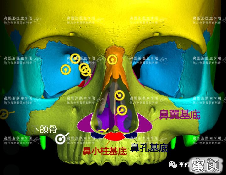 案例图片