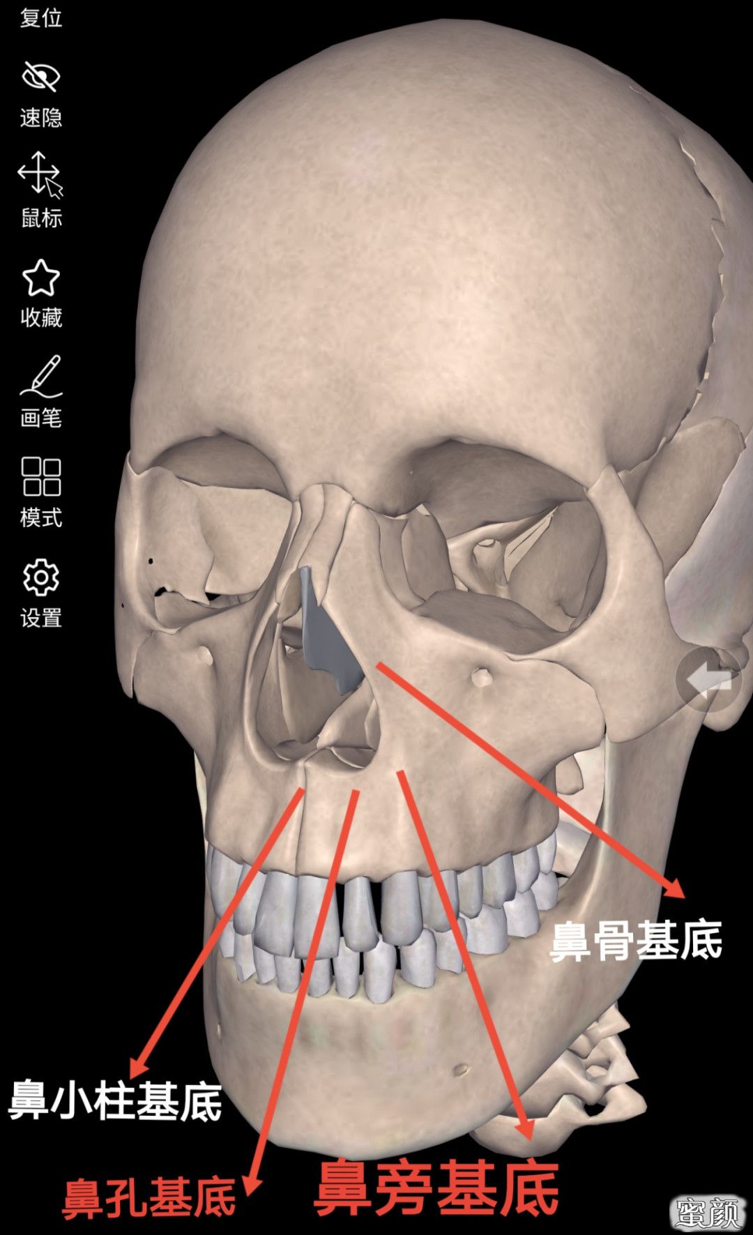 案例图片