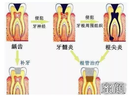 https://img.yiyiaimei.com/mnt/timg/210213/19420Q631-5.jpg