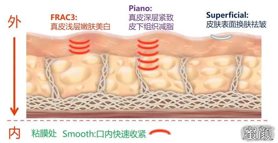 案例图片