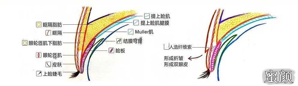 案例图片