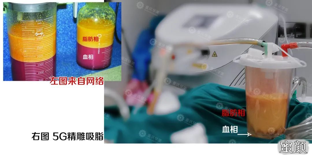 案例图片