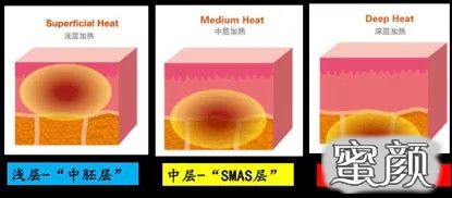 案例图片