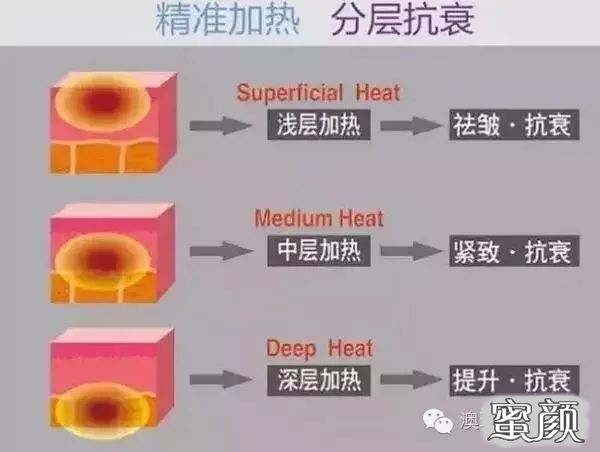 案例图片