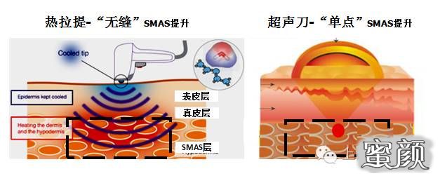 案例图片