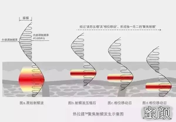 案例图片