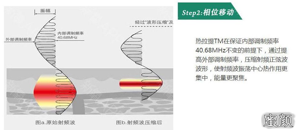 案例图片