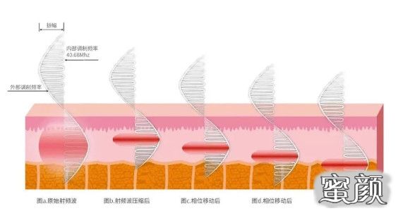 案例图片