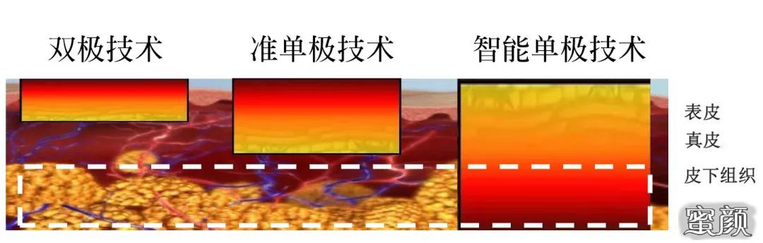 案例图片