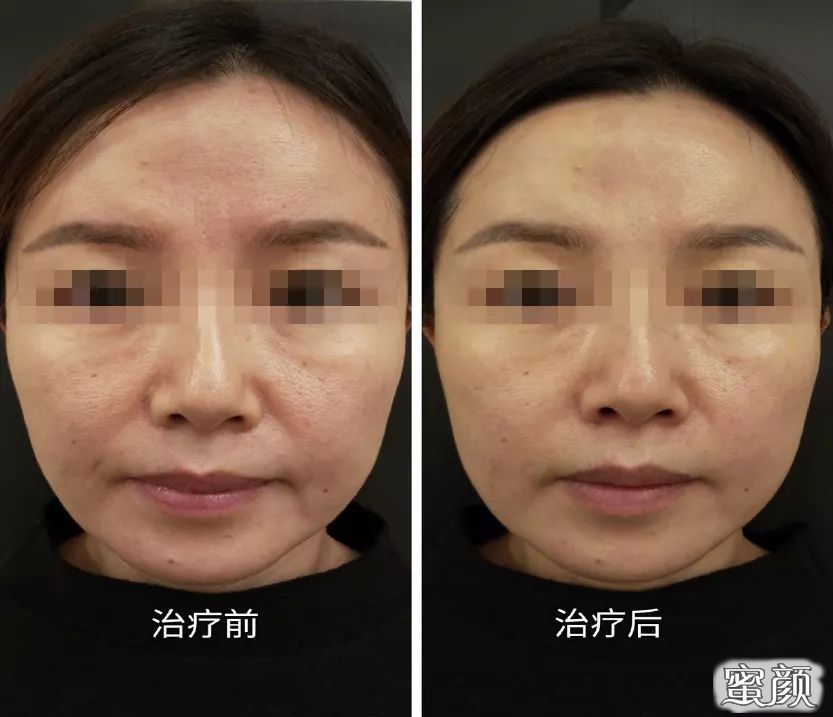 案例图片