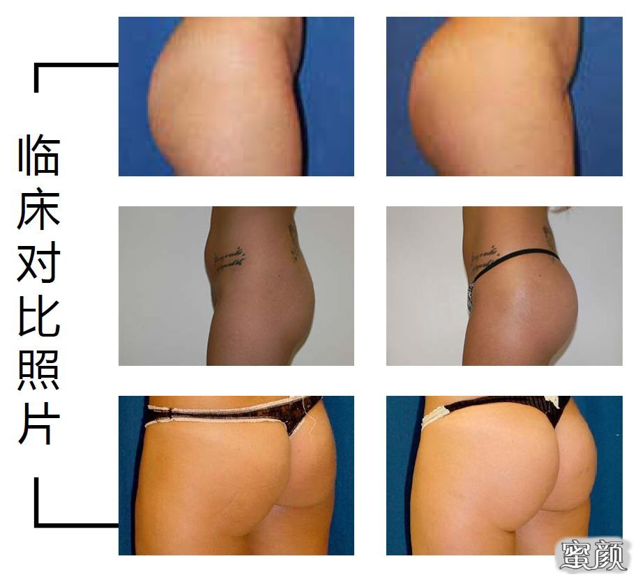 案例图片