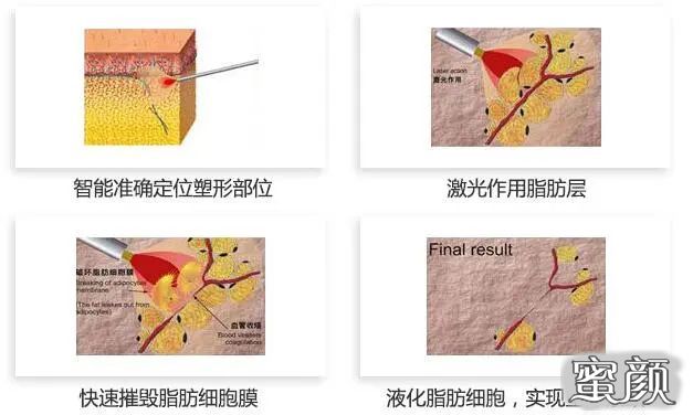 案例图片