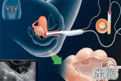案例图片