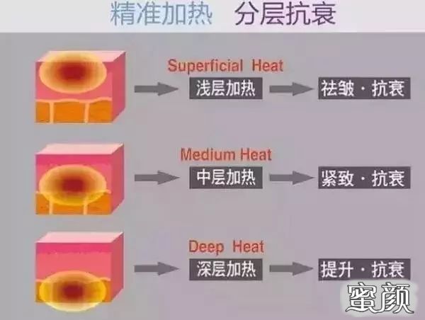 案例图片