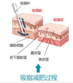 案例图片