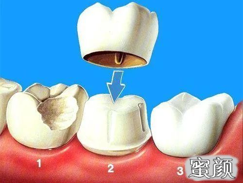 案例图片