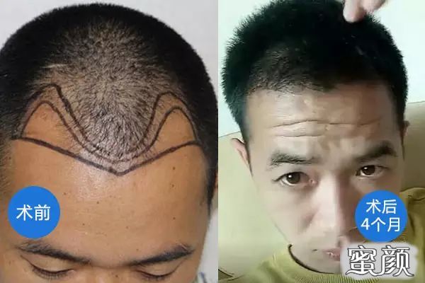 https://img.yiyiaimei.com/mnt/timg/210220/1620243461-2.jpg