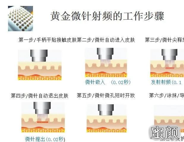 案例图片