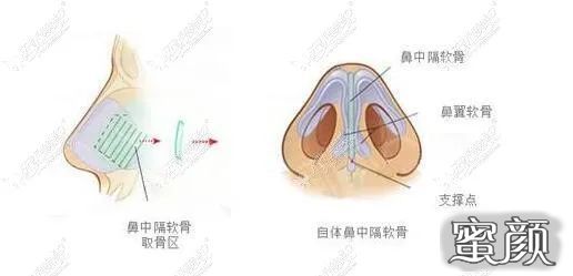 案例图片