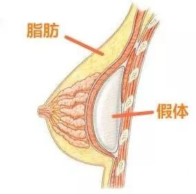 案例图片