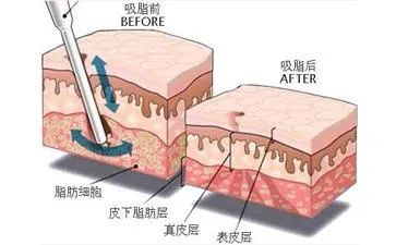 案例图片