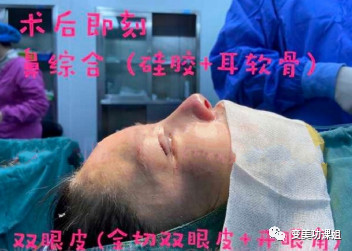 案例图片