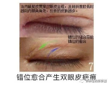 https://img.yiyiaimei.com/mnt/timg/210224/1122091624-8.jpg