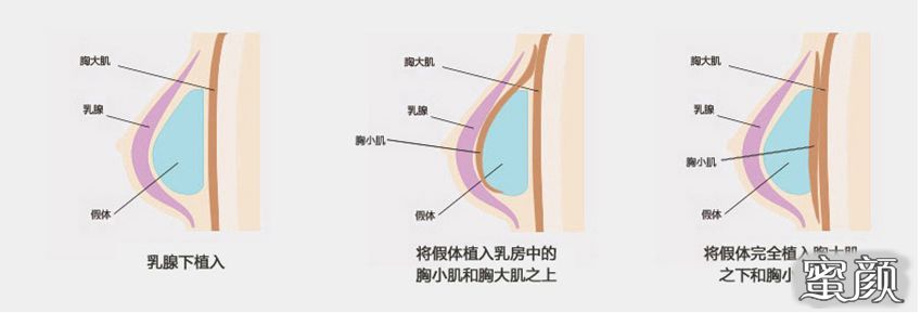 案例图片