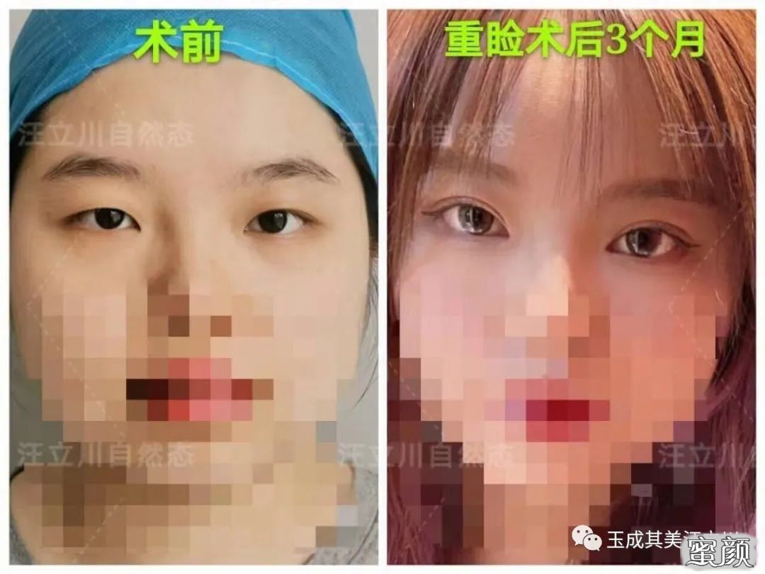 案例图片