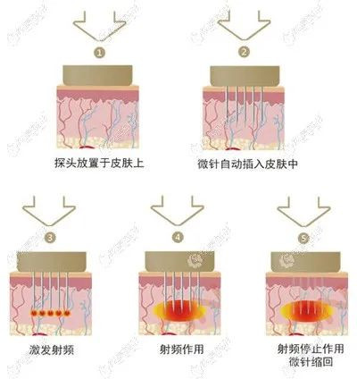 案例图片