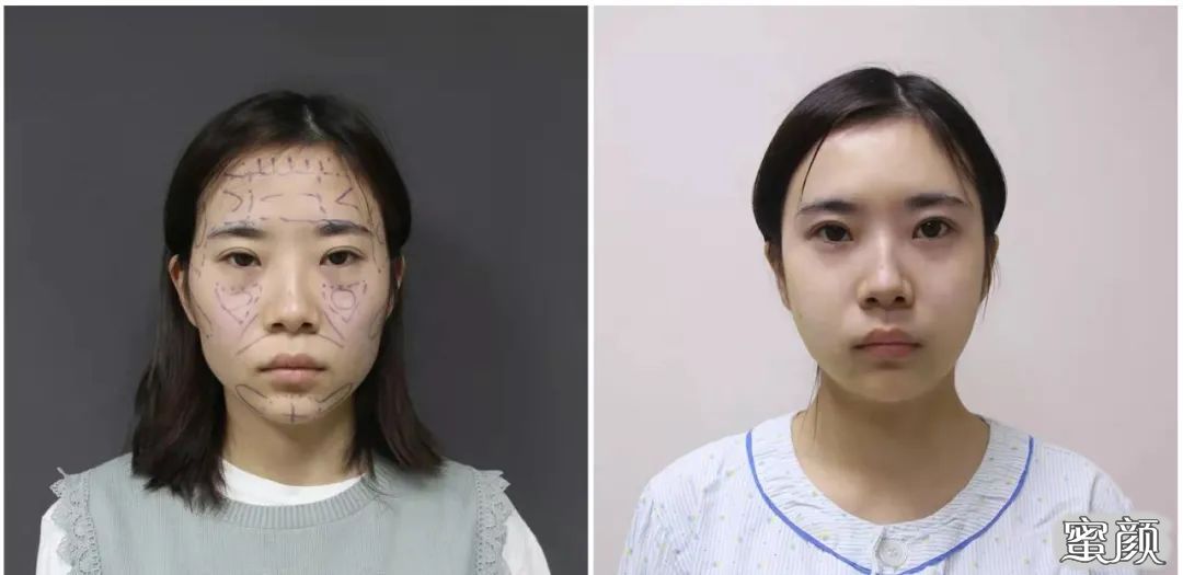 案例图片