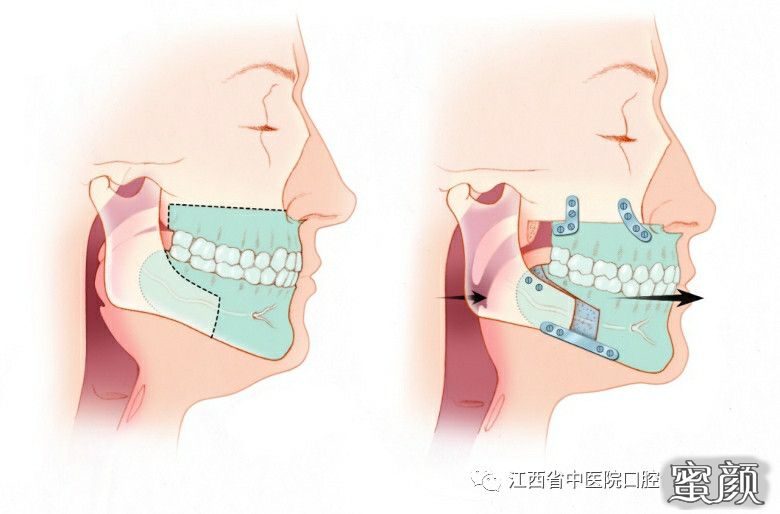 案例图片