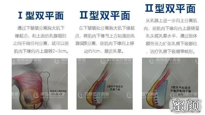 案例图片
