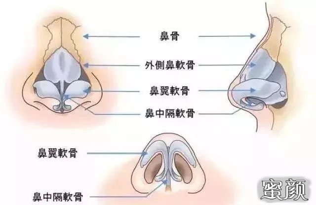 案例图片