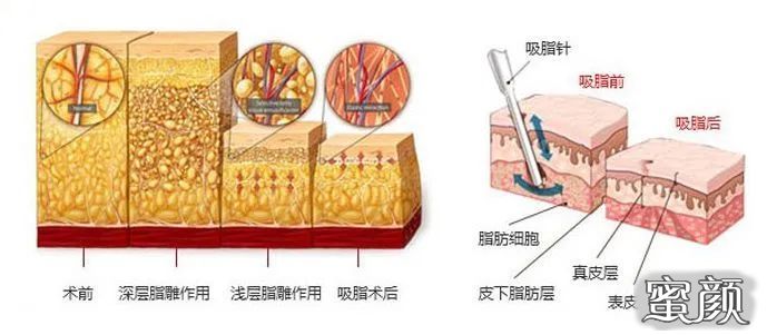 案例图片